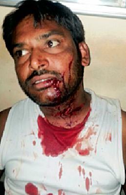 A fierce attack on the youth on the petrol pump | पेट्रोलपंपावरील तरुणावर प्राणघातक हल्ला A fierce attack on the youth on the petrol pump | पेट्रोलपंपावरील तरुणावर प्राणघातक हल्ला