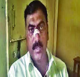 Fierce fighting | सावळे गावात हळदी समारंभात मारामारी