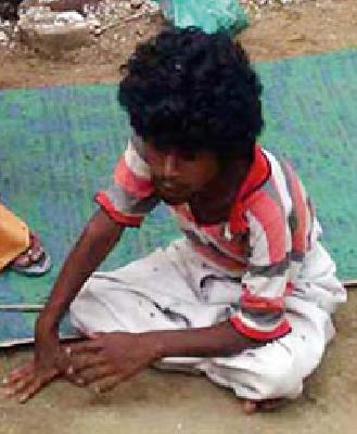 'That' the administration ready for the treatment of orphans | ‘त्या’ अनाथ मुलाच्या उपचारासाठी प्रशासन सज्ज