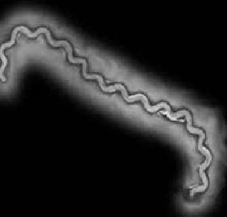 Lepto dies in Mumbai | मुंबईत लेप्टोने दोघांचा मृत्यू