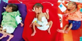 Reproductive tinctures: The mechanism of 'medical' system | तिळ्यांना पुनर्जन्म : ‘मेडिकल’च्या यंत्रणेची किमया