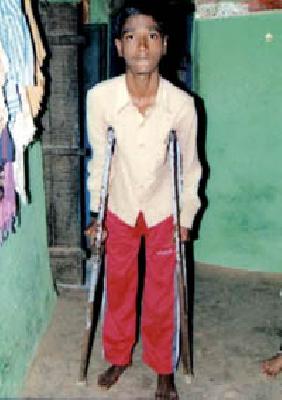 Disability Sameer's approach to the benefit of the unemployed scheme | निराधार योजनेच्या लाभासाठी अपंग समीरची फरफट