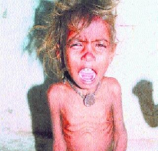 In Maharashtra, 256 tribal children died due to death | मोखाड्यात २५६ आदिवासी बालके मृत्यूच्या दाढेत