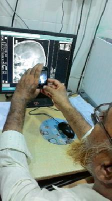 X-ray 'mobile-ray' | एक्स-रे नव्हे ‘मोबाईल-रे’ X-ray 'mobile-ray' | एक्स-रे नव्हे ‘मोबाईल-रे’