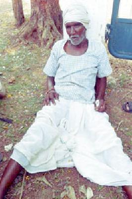 Forest workers wound up | वन कर्मचाऱ्यांची वृद्धाला मारहाण Forest workers wound up | वन कर्मचाऱ्यांची वृद्धाला मारहाण