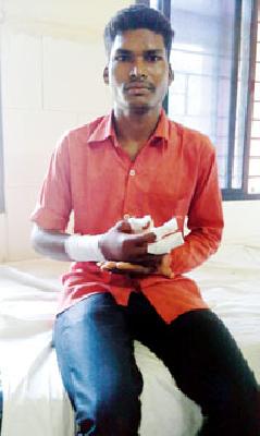 Police firing on tribal youth | आदिवासी तरूणावर पोलिसांनी झाडल्या गोळ्या Police firing on tribal youth | आदिवासी तरूणावर पोलिसांनी झाडल्या गोळ्या