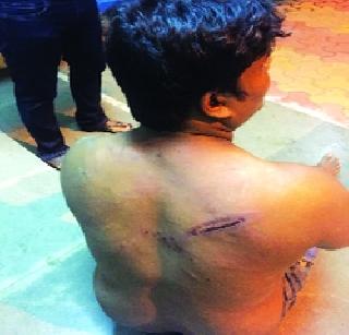 Three Dalit siblings have been assaulted in Virar | विरारमध्ये तीन दलित भावंडांना जबर मारहाण Three Dalit siblings have been assaulted in Virar | विरारमध्ये तीन दलित भावंडांना जबर मारहाण