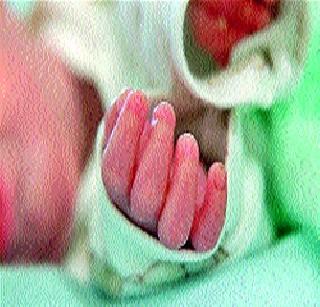 Dinosaur to stop poisonous brinjal | कोवळी पानगळ रोखण्यासाठी दहासूत्री Dinosaur to stop poisonous brinjal | कोवळी पानगळ रोखण्यासाठी दहासूत्री