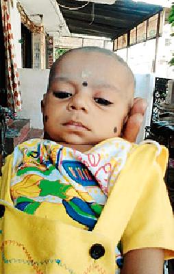 Mybapana struggles to survive in Chimukella | चिमुकल्याला जगविण्यासाठी मायबापाचा संघर्ष Mybapana struggles to survive in Chimukella | चिमुकल्याला जगविण्यासाठी मायबापाचा संघर्ष