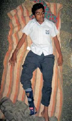 36 hours of travel without the help of the injured student | जखमी विद्यार्थ्याचा उपचाराविना ३६ तास प्रवास