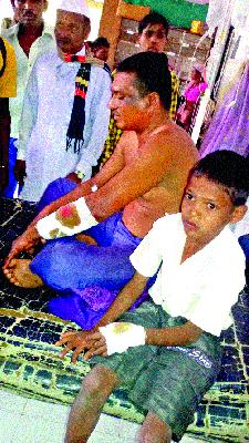 Father's son injured in leopard attack | बिबट्याच्या हल्ल्यात पितापुत्र जखमी