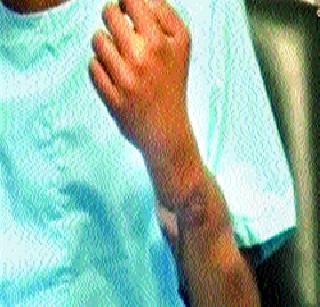 Submit proposal for transplant | प्रत्यारोपणासाठीचा प्रस्ताव सादर