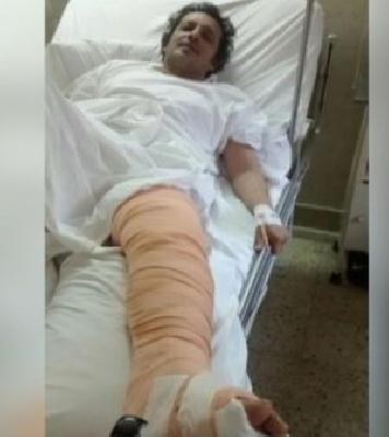 Manohole's thin lid, broken legs, lost job, notice to BMC for one and a half million | मॅनहोलच्या तुटक्या झाकणामुळे पाय मोडला, नोकरी गमावली, BMC ला दीड कोटीची नोटीस