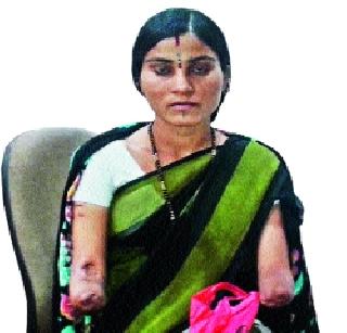 Poor gestures do not even lose hands | दोन्ही हात गमावूनही सोडली नाही हिंमत Poor gestures do not even lose hands | दोन्ही हात गमावूनही सोडली नाही हिंमत