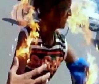 ABVP activists burnt in their own agitation | आपल्याच आंदोलनात ABVP चा कार्यकर्ता भाजला ABVP activists burnt in their own agitation | आपल्याच आंदोलनात ABVP चा कार्यकर्ता भाजला