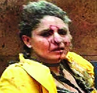 Not a funding gift even after 24 hours; Relatives of relatives | २४ तास उलटूनही निधीची भेट नाही; नातेवाईकांची धडपड Not a funding gift even after 24 hours; Relatives of relatives | २४ तास उलटूनही निधीची भेट नाही; नातेवाईकांची धडपड