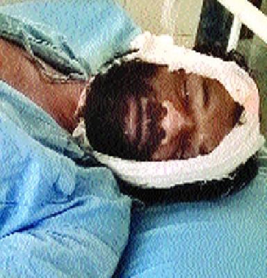 Nilesh Ranever crime in the murder case | मारहाणप्रकरणी निलेश राणेंवर गुन्हा