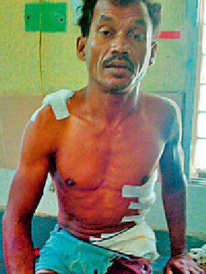 She is injured in the beleaguered attack | अस्वलाच्या हल्ल्यात इसम जखमी