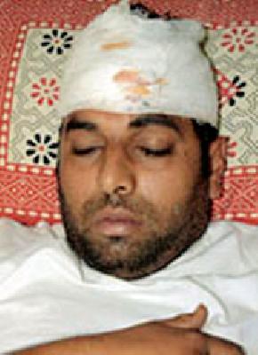 Hotel Hilltop Operators Attack | हॉटेल हिलटॉपच्या संचालकावर हल्ला