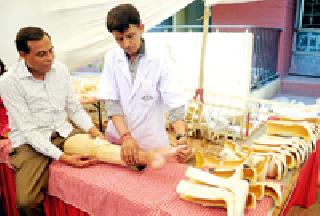 Improvisation of the prosthetic limbs | कृत्रिम अवयव प्रत्यारोपणाने दिले बळ Improvisation of the prosthetic limbs | कृत्रिम अवयव प्रत्यारोपणाने दिले बळ