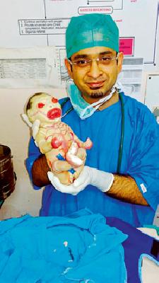 The birth of the child 'Harqilain' in Nagpur | नागपुरात ‘हरक्विलीन’ बाळाचा जन्म The birth of the child 'Harqilain' in Nagpur | नागपुरात ‘हरक्विलीन’ बाळाचा जन्म
