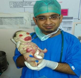 The death of Harlequin Baby in Nagpur | नागपूरमधील त्या हर्लेक्विन बेबीचा मृत्यू The death of Harlequin Baby in Nagpur | नागपूरमधील त्या हर्लेक्विन बेबीचा मृत्यू