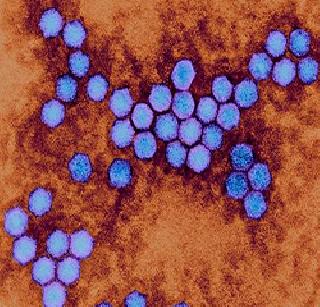 Polio virus found in Hyderabad after five years | पाच वर्षांनंतर हैदराबादेत आढळला पोलिओचा विषाणू Polio virus found in Hyderabad after five years | पाच वर्षांनंतर हैदराबादेत आढळला पोलिओचा विषाणू
