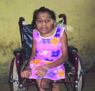 82 percent of disabled poetry | अपंग कविताला ८२ टक्के