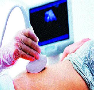 Penis stimulus | लिंगपरीक्षेस उत्तेजन