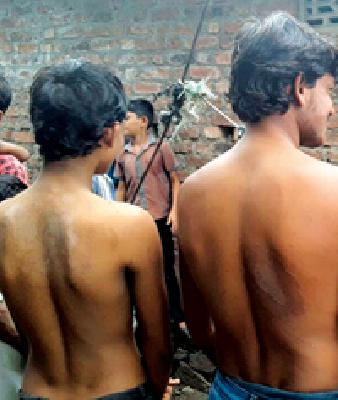 Fungal Disease sufferers suffer | बुरशीजन्य आजाराने रुग्ण बेजार