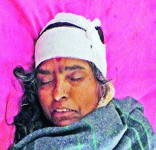 Her husband is seriously injured in the murder of a thief | चोरट्यांच्या मारहाणीत दाम्पत्य गंभीर जखमी Her husband is seriously injured in the murder of a thief | चोरट्यांच्या मारहाणीत दाम्पत्य गंभीर जखमी