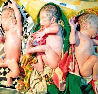 The birth of tilis in the city | नगरमध्ये तिळ्यांचा जन्म The birth of tilis in the city | नगरमध्ये तिळ्यांचा जन्म