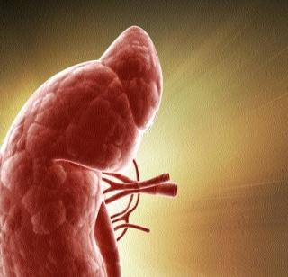 Kidney racket case: ED will also investigate | किडनी रॅकेट प्रकरणी ईडीही करणार चौकशी Kidney racket case: ED will also investigate | किडनी रॅकेट प्रकरणी ईडीही करणार चौकशी