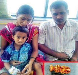 Above! Goddess Idol left out of the stomach | अबब ! चिमुरड्याच्या पोटातून निघाली देवीची मूर्ती Above! Goddess Idol left out of the stomach | अबब ! चिमुरड्याच्या पोटातून निघाली देवीची मूर्ती