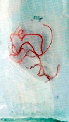 Animal supply in the Salekasa area | सालेकसा परिसरात जंतुयुक्त पाण्याचा पुरवठा