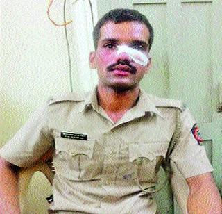Police brutal assault on policeman | पोलिसाला तरुणाची बेदम मारहाण Police brutal assault on policeman | पोलिसाला तरुणाची बेदम मारहाण
