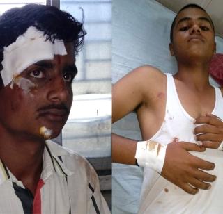 Shinde Sevak's tractor turns 12 injured in Buldhana | बुलढाण्यात शिस्तसेवकांचा ट्रॅक्टर उलटून १२ जखमी Shinde Sevak's tractor turns 12 injured in Buldhana | बुलढाण्यात शिस्तसेवकांचा ट्रॅक्टर उलटून १२ जखमी