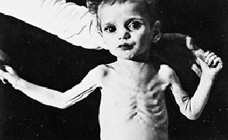 The dream of living alive | जिवंत राहण्याचे स्वप्न The dream of living alive | जिवंत राहण्याचे स्वप्न