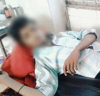 Pervert! Petrol pistol with theft of mobile theft | विकृत ! मोबाईल चोरीच्या संशयावरुन गुप्तांगात पेट्रोल टाकून मारहाण