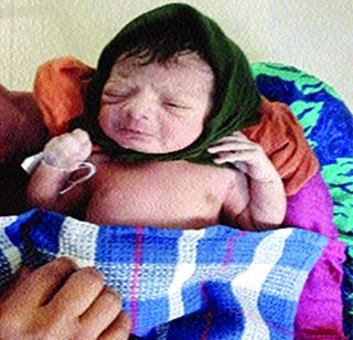 Birth of a daughter in the form of father's organs | पित्याच्या अवयवदानाप्रसंगी कन्येचा जन्म