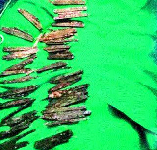Aab ... 40 knives removed from the stomach | अबब... पोटातून काढले तब्बल ४० चाकू Aab ... 40 knives removed from the stomach | अबब... पोटातून काढले तब्बल ४० चाकू