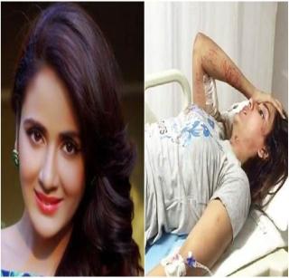 Actress seriously injured in the attack by dogs | भटक्या कुत्र्यांच्या हल्ल्यात अभिनेत्री गंभीर जखमी Actress seriously injured in the attack by dogs | भटक्या कुत्र्यांच्या हल्ल्यात अभिनेत्री गंभीर जखमी