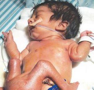 The new life of the child of four legs | चार पायांच्या बाळाला मिळालं नवीन आयुष्य