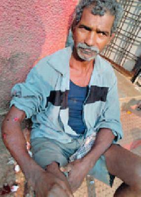 She is injured in the beleaguered attack | अस्वलाच्या हल्ल्यात इसम जखमी