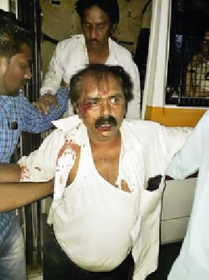 Suicide busters kill both | अंबाझरीत दोघांना जबर मारहाण Suicide busters kill both | अंबाझरीत दोघांना जबर मारहाण