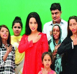 'Rehabilitation with the reputation of acid attack victims' | ‘अॅसिड हल्ल्यातील जखमींचे प्रतिष्ठेसह पुनर्वसन करणार’ 'Rehabilitation with the reputation of acid attack victims' | ‘अॅसिड हल्ल्यातील जखमींचे प्रतिष्ठेसह पुनर्वसन करणार’