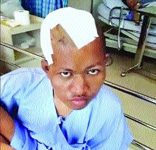 Twice collected from the head size | डोक्याच्या आकारापेक्षा दुप्पट गोळा काढला Twice collected from the head size | डोक्याच्या आकारापेक्षा दुप्पट गोळा काढला