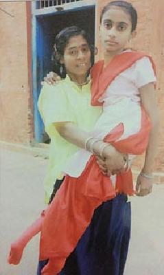 Dual test for both the feet, giving disability | दोन्ही पायांनी अपंग रूपा देतेय दहावीची परीक्षा