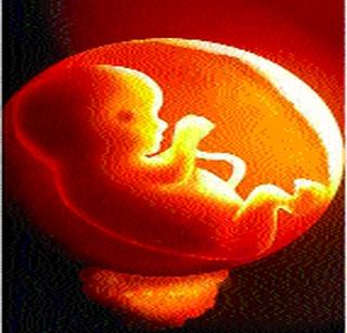 No report against abortion center in 4 years | गर्भपात केंद्राविरुद्ध ४ वर्षांत नाही एकही तक्रार No report against abortion center in 4 years | गर्भपात केंद्राविरुद्ध ४ वर्षांत नाही एकही तक्रार