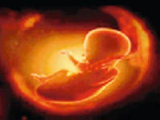 Report the names of those who have killed | भू्रण हत्या करणाऱ्यांचे नाव कळवा